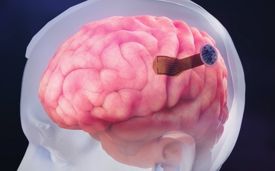 脑机接口新突破马斯克合伙人造出大脑皮层有望进行人体测试